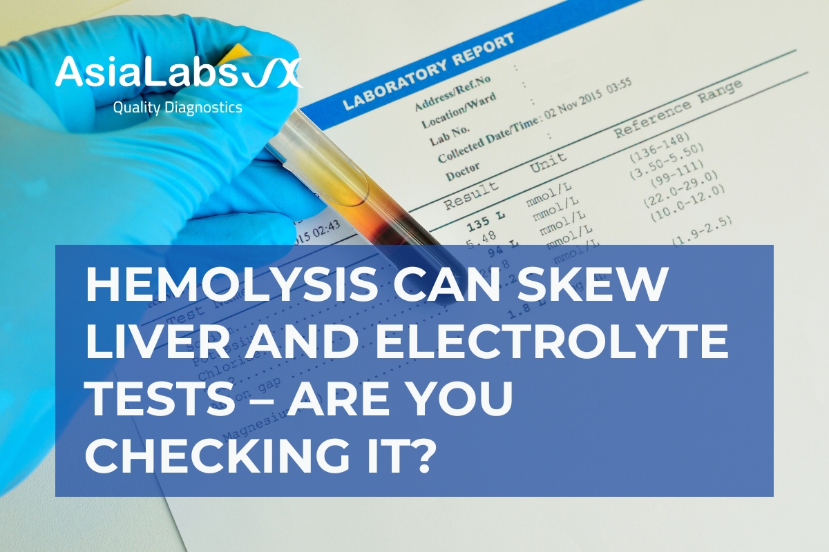 Hemolysis Can Skew Liver and Electrolyte Tests – Are You Checking It