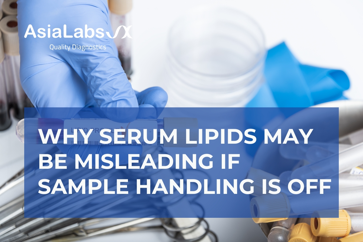 Why Serum Lipids May Be Misleading If Sample Handling Is Off